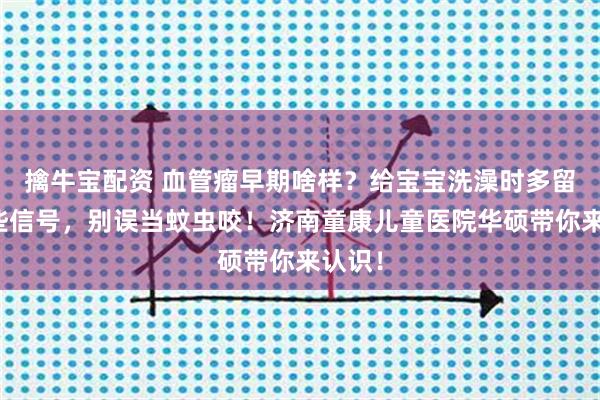 擒牛宝配资 血管瘤早期啥样？给宝宝洗澡时多留意这些信号，别误当蚊虫咬！济南童康儿童医院华硕带你来认识！